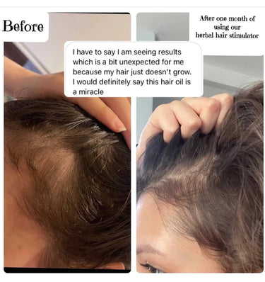 Best selling: Herbal Hair Stimulator