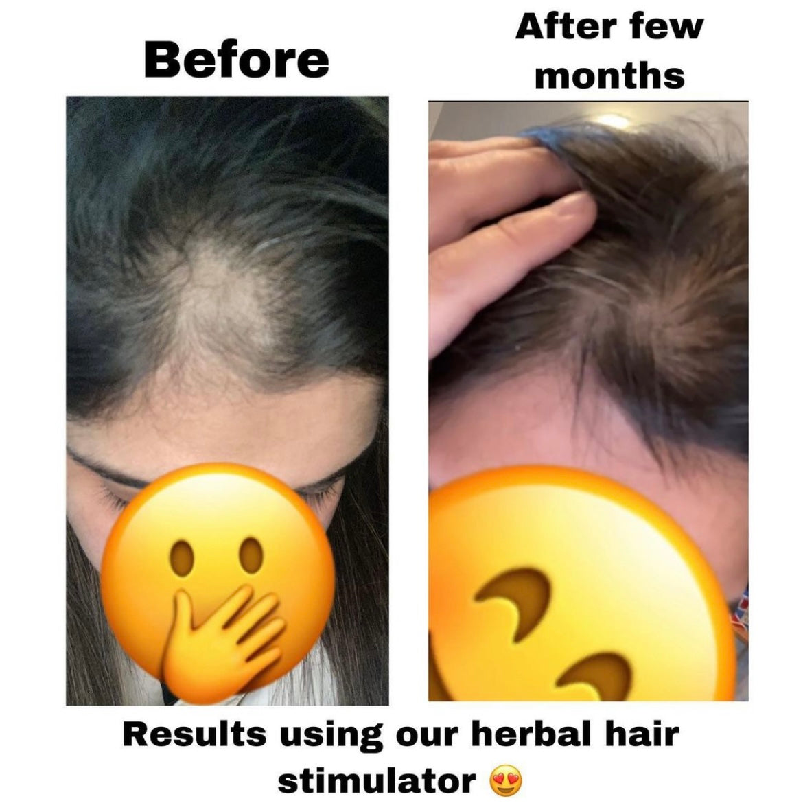 Best selling: Herbal Hair Stimulator